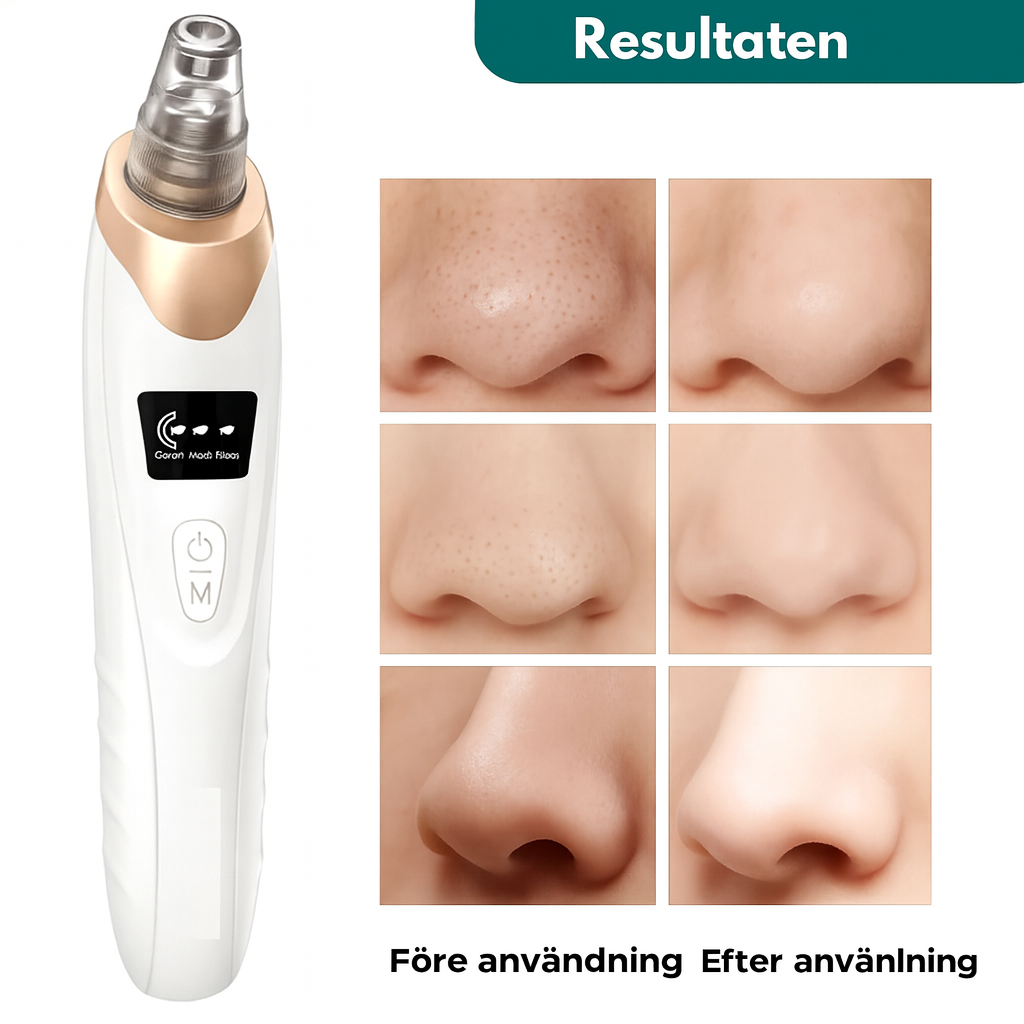 PoreVac™ - Renar på djupet, förfinar och gör huden silkeslen utan dyra behandlingar.